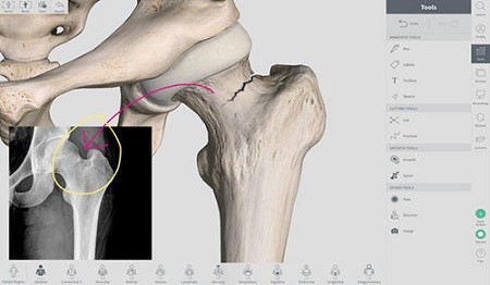 Complete Anatomy Mac