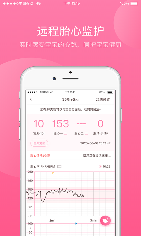 掌上孕育