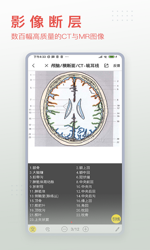 3DBody解剖