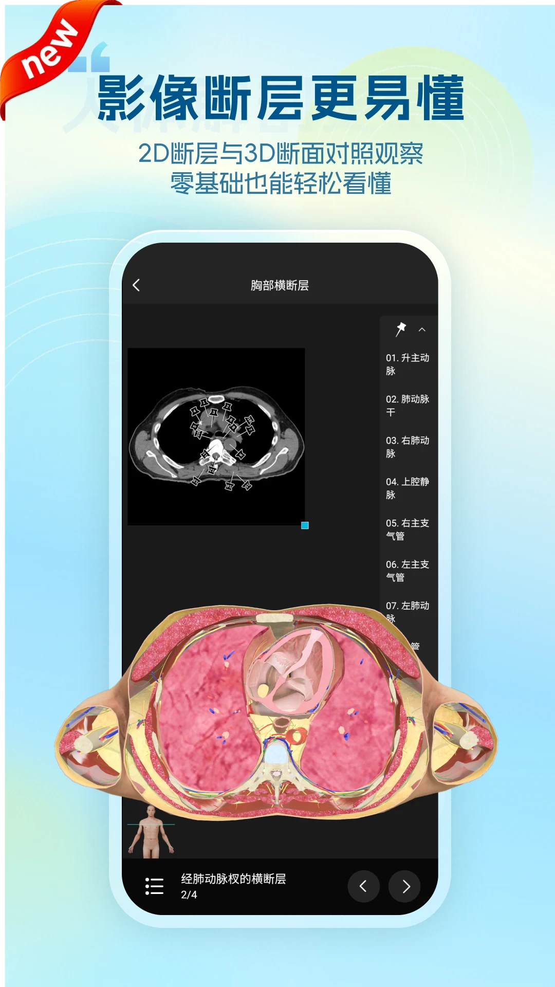 维萨里3D解剖截图